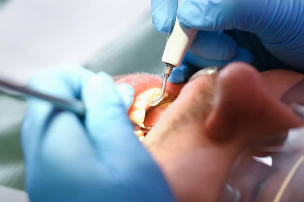 Best Emergency Treatment for Oral Infections in Elmo, TX