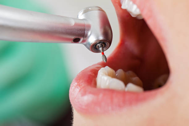 Best Weekend Emergency Dental Services in Elmo, TX